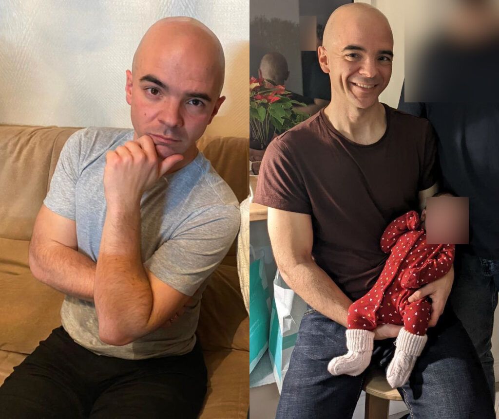 Antes y después de comer al 50%. Pérdida de 4 Kg